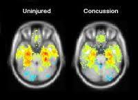 UIL brings focus to concussions