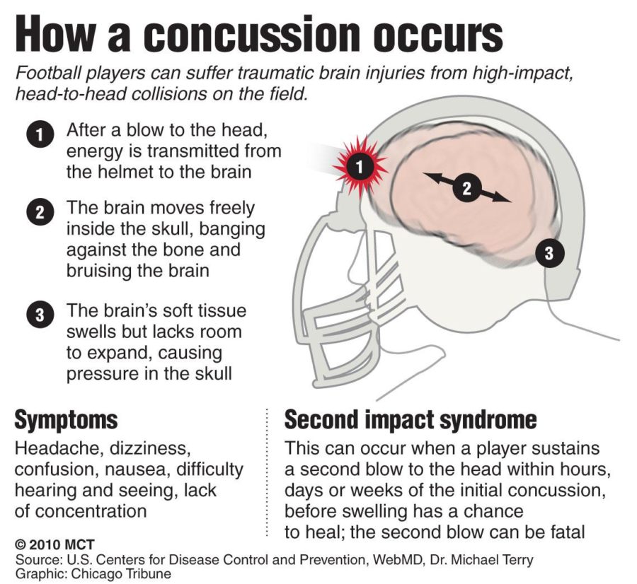 How football related concussions occur