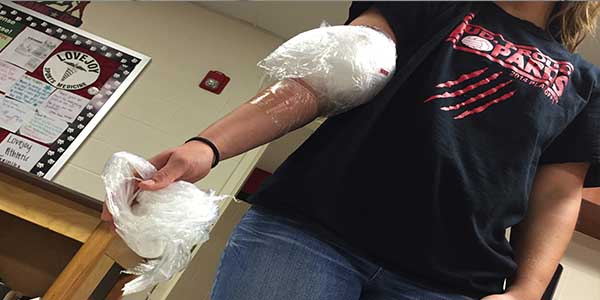 Athletes such as softball player Samantha OBrien icing an injury is a common sight in the schools training room, but recent research suggests ice may not be the best course of treatment for all injuries. 
