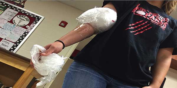 Athletes such as softball player Samantha O'Brien icing an injury is a common sight in the school's training room, but recent research suggests ice may not be the best course of treatment for all injuries. 